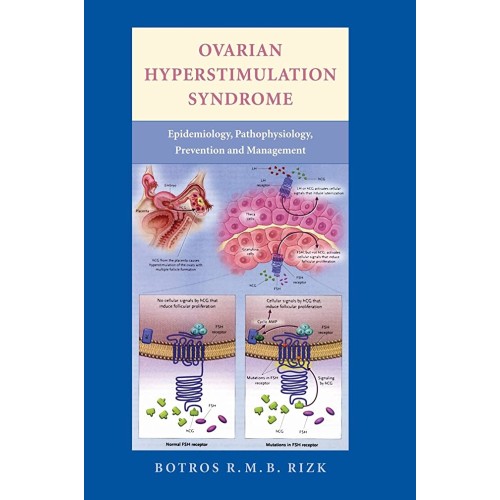 Ovarian Hyperstimulation Syndrome (Hb 2006) 