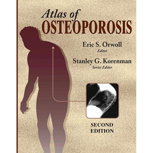 Atlas Of Osteoporosis 2Ed 