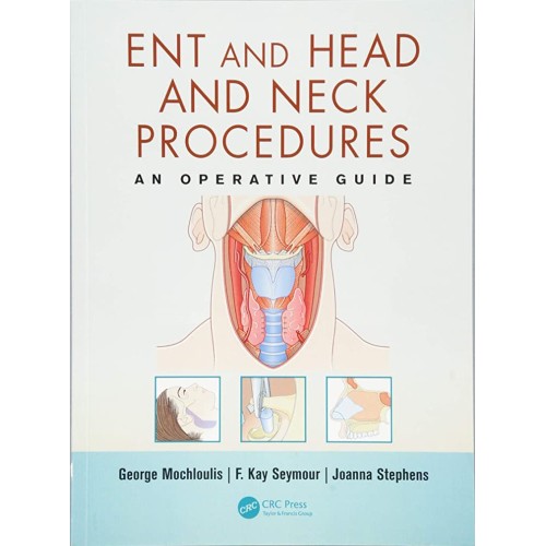 Ent And Head And Neck Procedures An Operative...