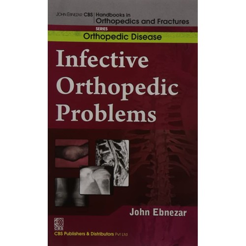 Infective Orthopedic Problems Developmental O...