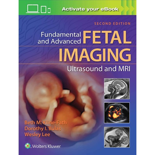 Fundamental And Advanced Fetal Imaging Ultras...