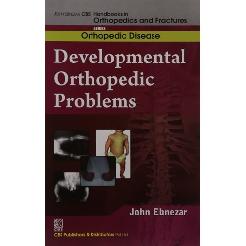 Developmental Orthopedic Problems (Handbooks ...