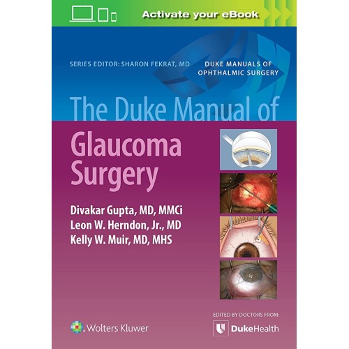 The Duke Manual Of Glaucoma Surgery (Pb 2022)