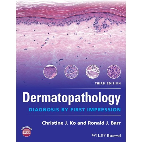 Dermatopathology Diagnosis By First Impressio...