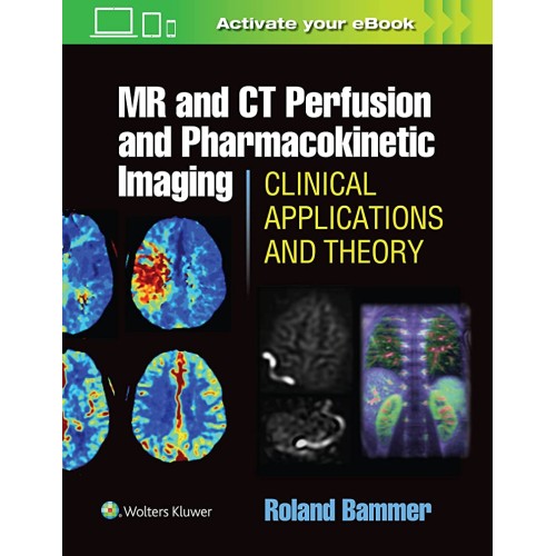 Mr And Ct Perfusion And Pharmacokinetic Imagi...