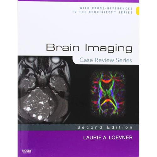 Brain Imaging Case Review Series 2Ed (Pb 2009...