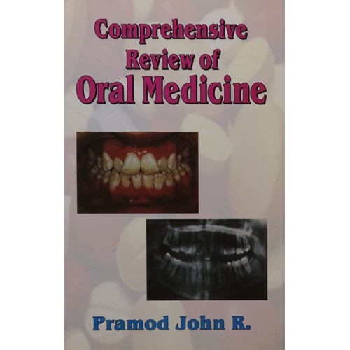 Comprehensive Review Of Oral Medicine 