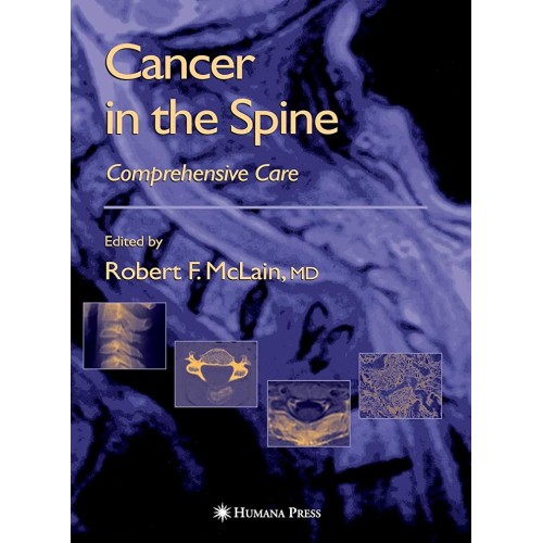 Cancer In The Spine: Comprehensive Care (Hb) 