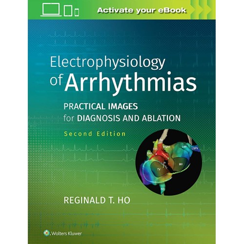 Electrophysiology Of Arrhythmias Practical Im...