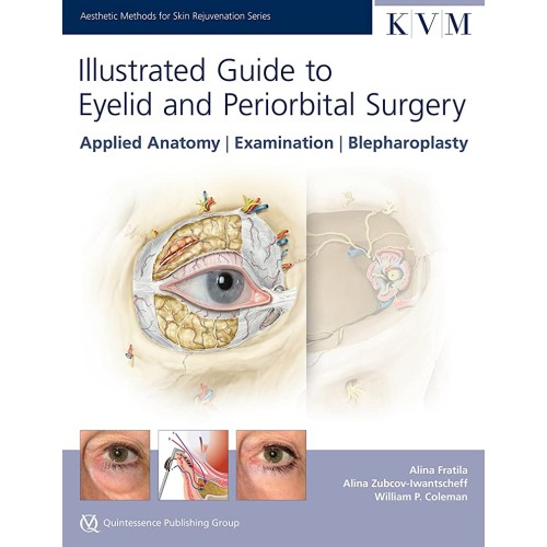 Illustrated Guide To Eyelid And Periorbital S...