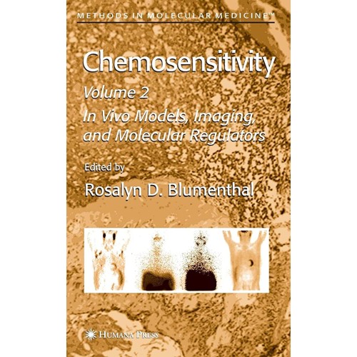 Chemosensitivity, Vol-2 (Hb) 