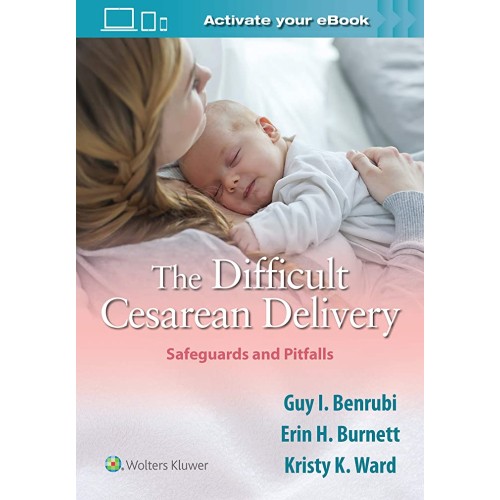 The Difficult Cesarean Delivery Safeguards An...