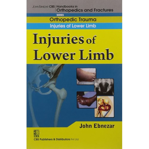 Injuries Of Lower Limb (Handbook In Orthopedi...