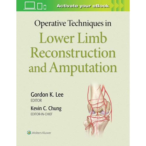 Operative Techniques In Lower Limb Reconstruc...