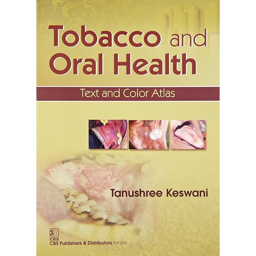 Tobacco And Oral Health Text And Color Atlas ...