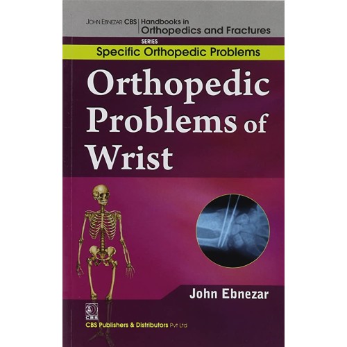 Orthopedic Problems Of Wrist (Handbooks In Or...