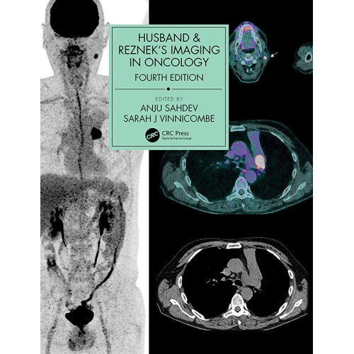 Husband And Rezneks Imaging In Oncology 4Ed (...