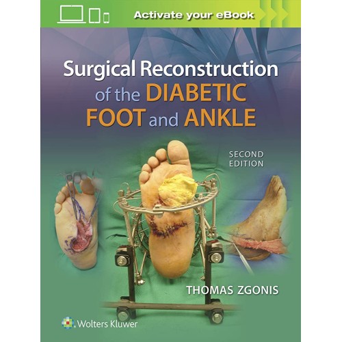 Surgical Reconstruction Of The Diabetic Foot ...