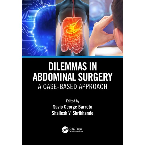 Dilemmas In Abdominal Surgery A Case Based Ap...