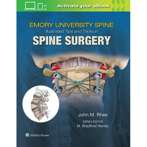 Emorys University Spine Illustrated Tips And ...