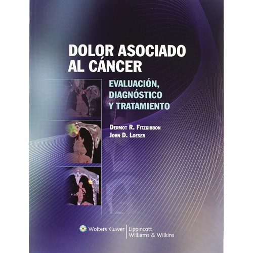 Dolor Asociado Al Cancer (Pb 2011)