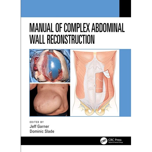 Manual Of Complex Abdominal Wall Reconstructi...