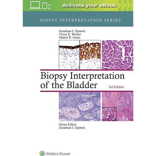 Biopsy Interpretation Of The Bladder 3Ed (Hb ...