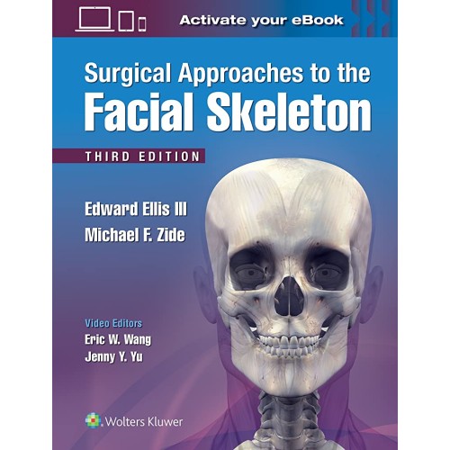 Surgical Approaches To The Facial Skeleton 3E...