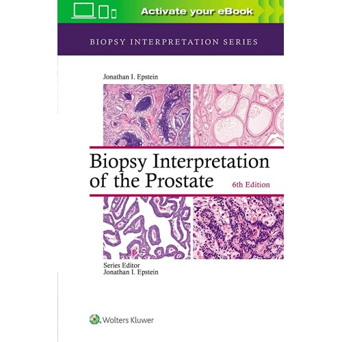 Biopsy Interpretation Of The Prostate 6Ed (Hb...