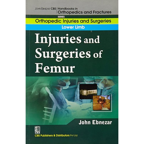 Injuries And Surgeries Of Femur (Handbooks In...