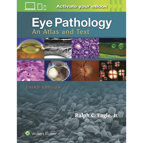 Eye Pathology An Atlas  And Text 3Ed (Hb 2017...