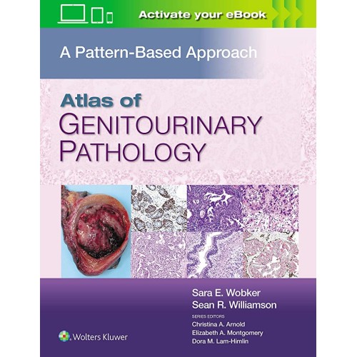 Atlas Of Genitourinary Pathology A Pattern Ba...