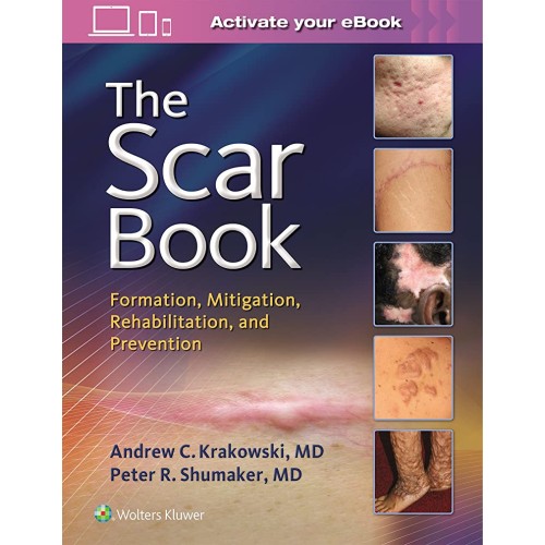 The Scar Book Formation Mitigation Rehabilita...