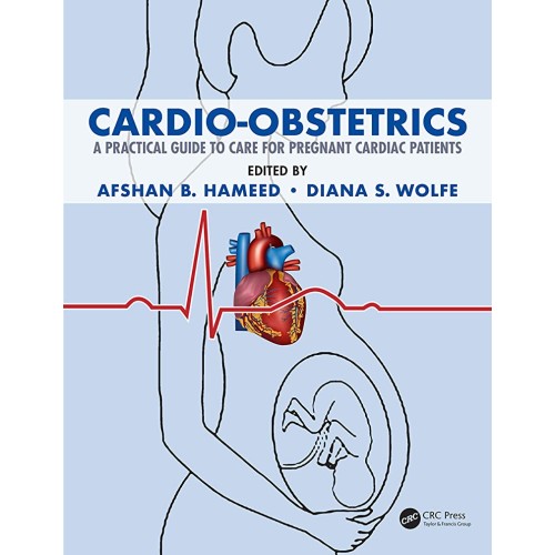 Cardio Obstetrics A Practical Guide To Care F...