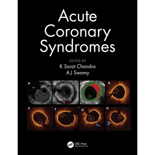 Acute Coronary Syndromes (Pb 2020)