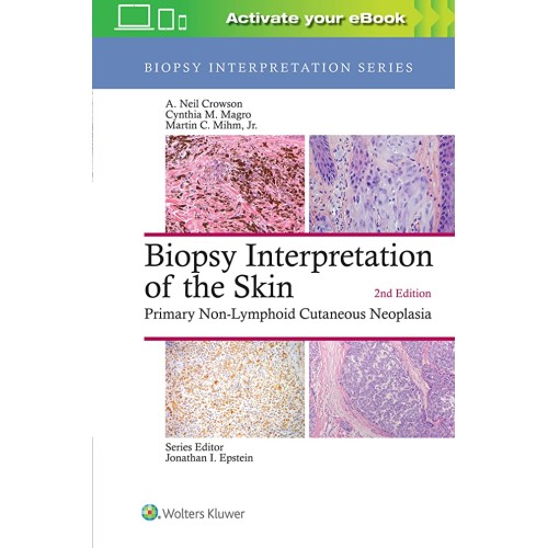 Biopsy Interpretation Of The Skin Primary Non...