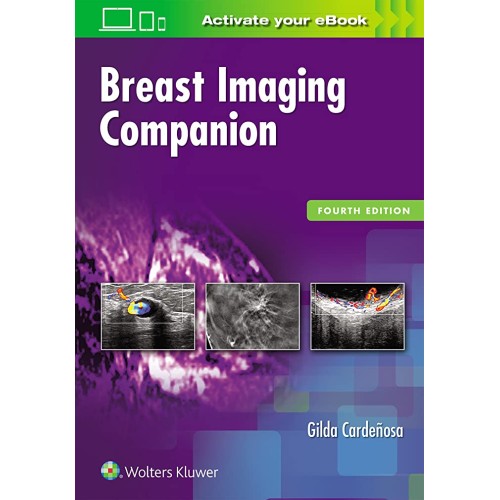 Breast Imaging Companion 4Ed (Pb 2017) 