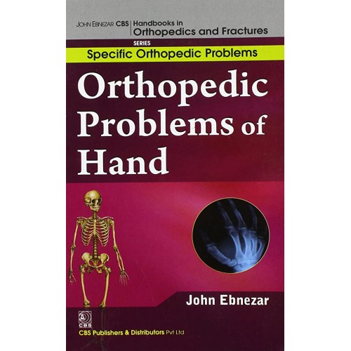 Orthopedic Problems Of Hand (Handbooks In Ort...