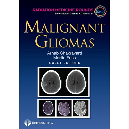 Malignant Gliomas (Hb 2012) 