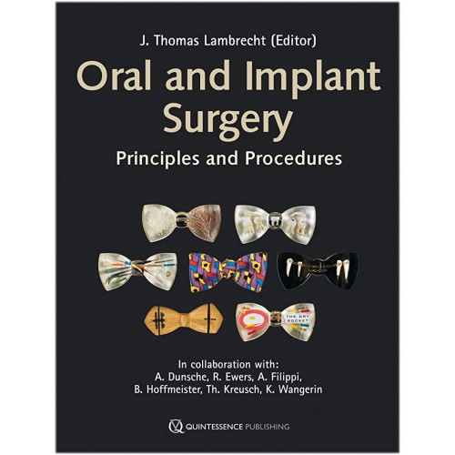 Oral And Implant Surgery Principles And Proce...