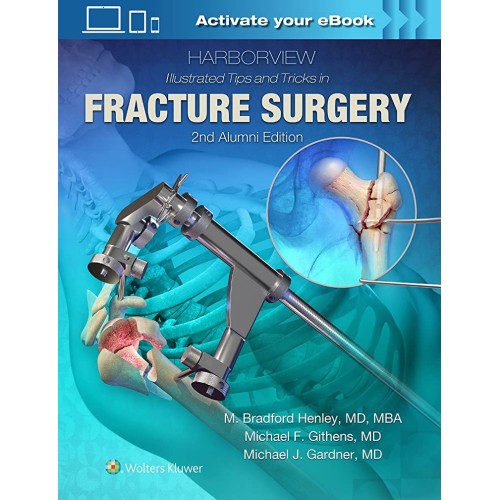 Harborview Illustrated Tips And Tricks In Fra...