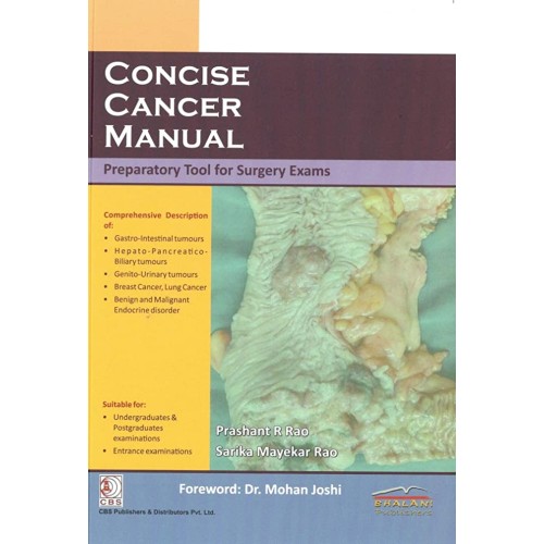 Concise Cancer Manual (Pb 2018) 