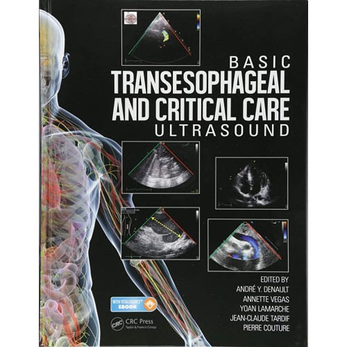 Basic Transesophageal And Critical Care Ultra...