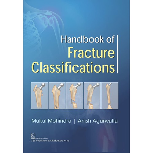 Handbook Of Fracture Classifications (Pb 2017...