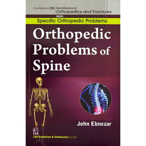 Orthopedic Problems Of Spine (Handbooks In Or...