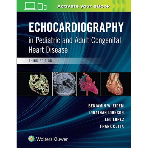 Echocardiography In Pediatric And Adult Conge...