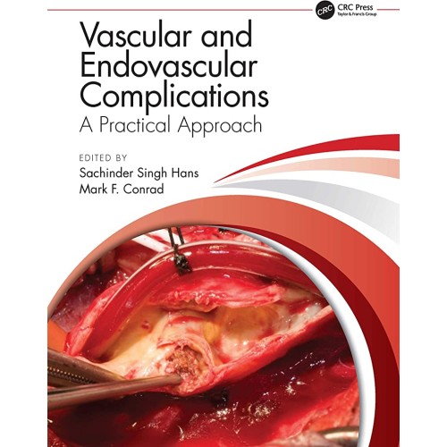 Vascular And Endovascular Complications A Pra...