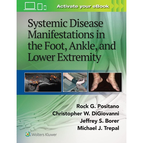 Systemic Disease Manifestations In The Foot A...