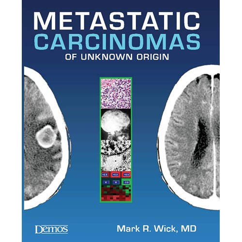 Metastatic Carcinomas Of Unknown Origin (Hb 2...