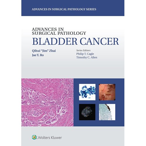 Advances In Surgical Pathology Bladder Cancer...